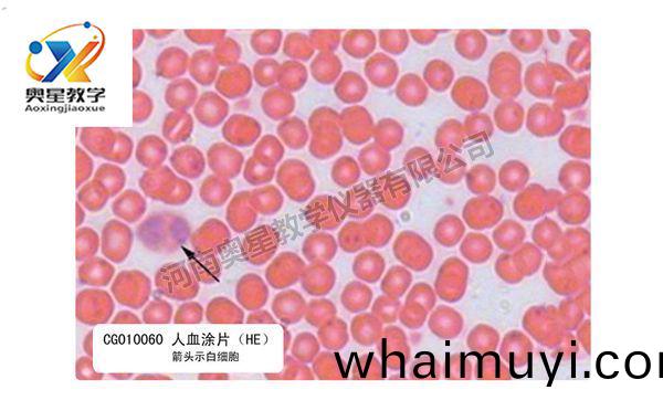 人(ren)血塗(tu)片