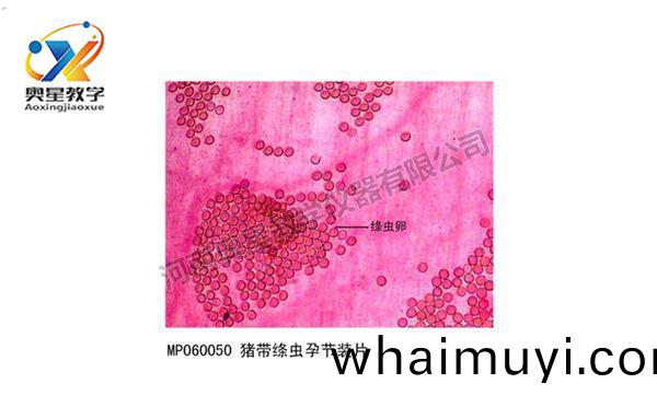 豬(zhu)帶縧蟲(chong)孕節(jie)