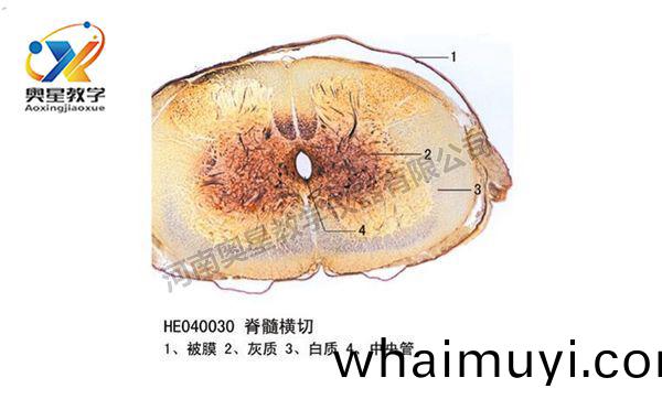 脊髓(sui)橫切