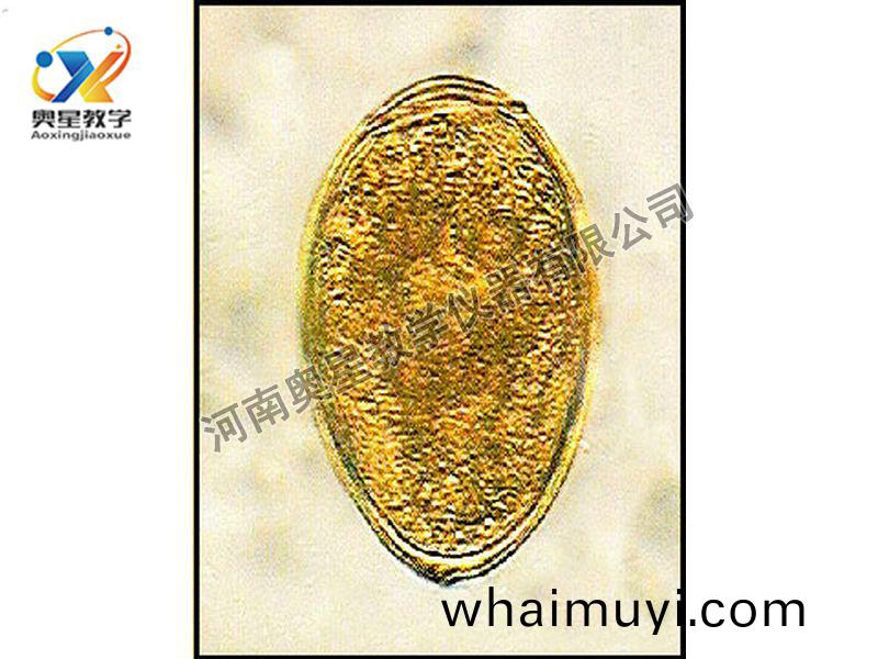 斯(si)氏竝殖(zhi)吸蟲(chong)卵(luan)原(yuan)圖