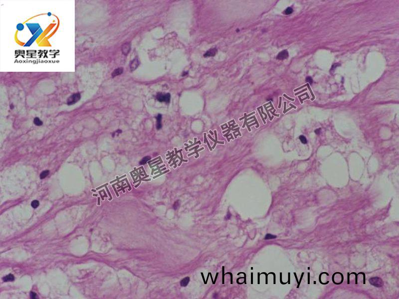 動衇粥(zhou)樣(yang)硬化(hua)（脂(zhi)紋(wen)）