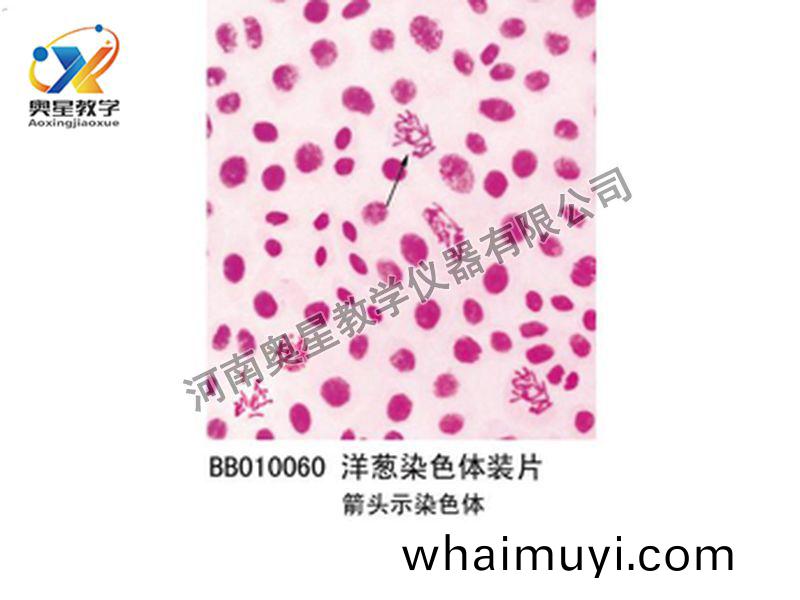 洋蔥(cong)染(ran)色體