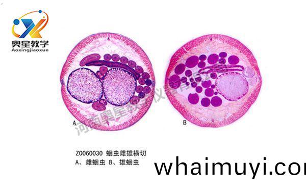 植物(wu)學標本(ben)廠傢：植(zhi)物病理切(qie)片(pian)的選材問(wen)題(ti)
