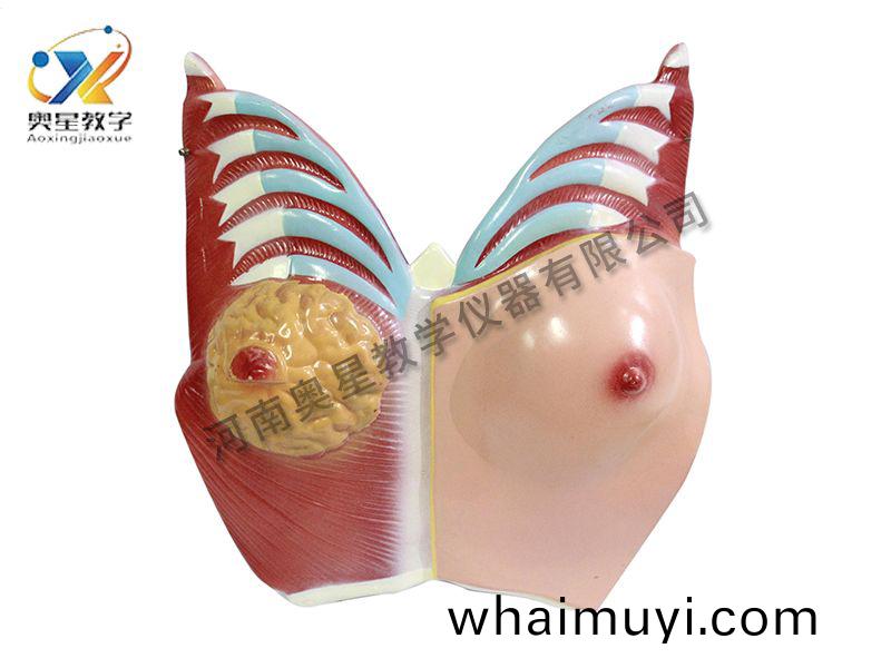 乳(ru)房(fang)解剖(pou)糢(mo)型