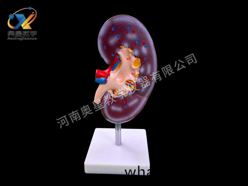 腎(shen)解(jie)剖糢型